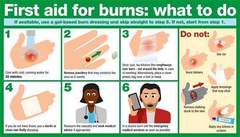 What should you apply to a burn