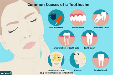 What should you take for a toothache