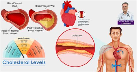 What should your cholesterol and triglycerides be
