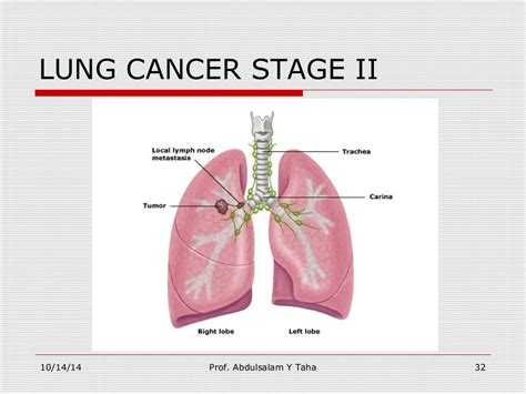 What stage is an 8 cm tumor in the lung HealthTap …