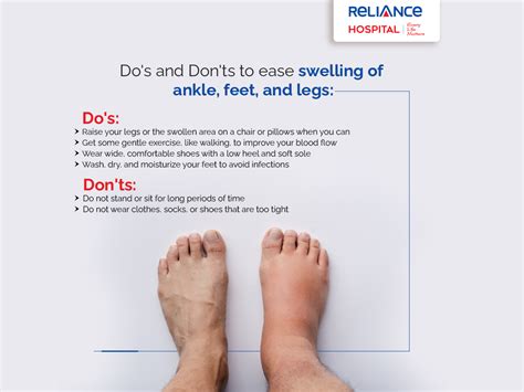What stops swelling in feet
