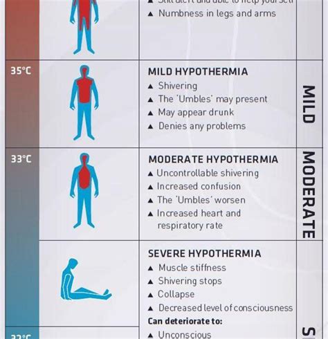 What temperature can cause hyperthermia