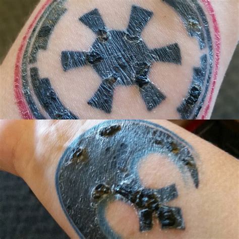 What to Do When Tattoo Is Peeling and the Ink Is Coming