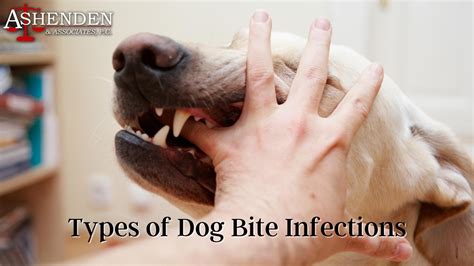 What to do in a dog bite
