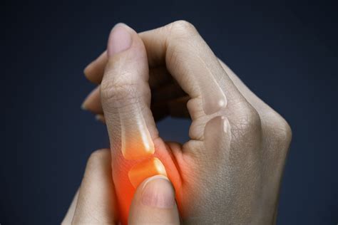 What to expect after a broken thumb Recovery & Rehabilitation Tips