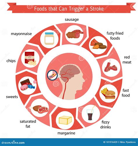 What will trigger a stroke