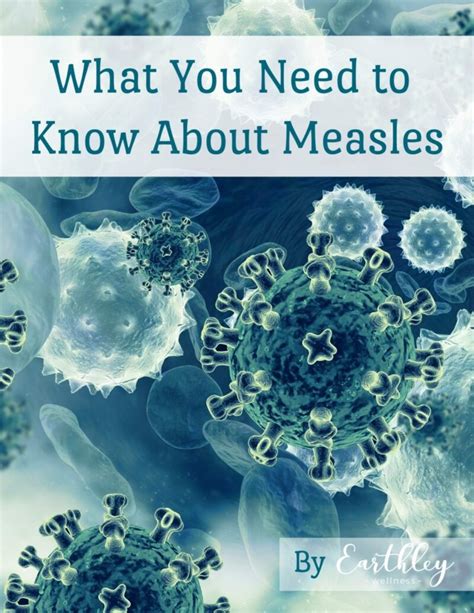 What women need to know about measles and …