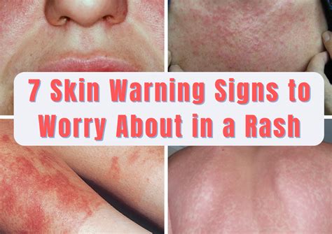 When To Worry About A Rash In Adults 7 Skin Warning Signs