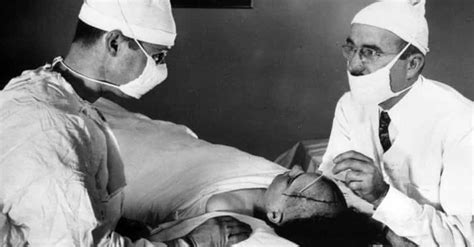 When Was The Last Lobotomy Performed In The US? - Caniry