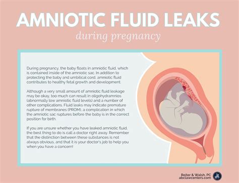When amniotic fluid leaks is it continuous