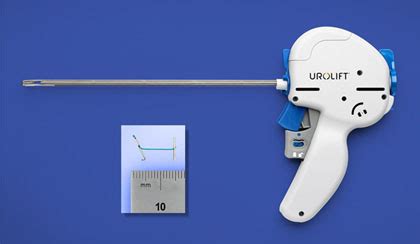 When did FDA approve UroLift? - Daily Justnow