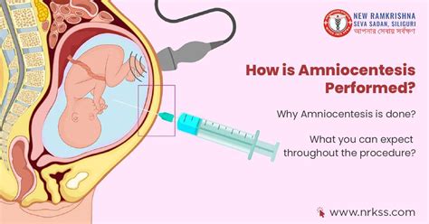 When is amniocentesis performed