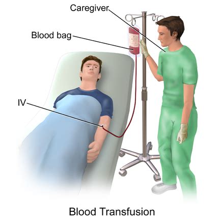 When is blood transfusion needed in dengue