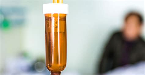 When is chemo used for lupus