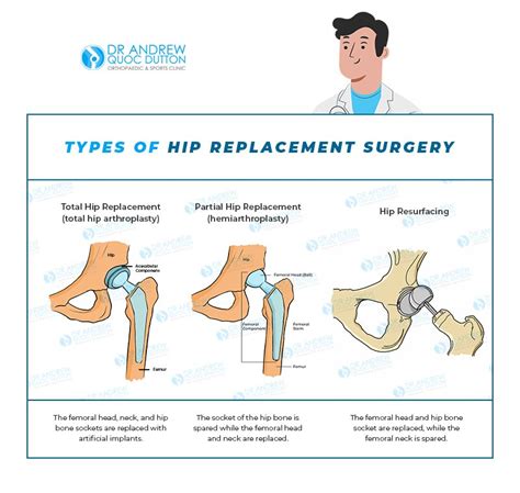 When is hip surgery needed