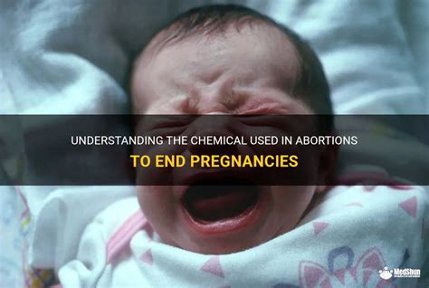When is it considered abortion