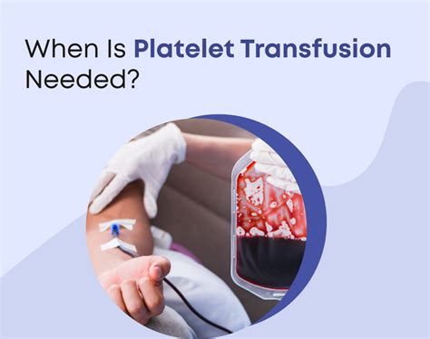 When platelet transfusion is required