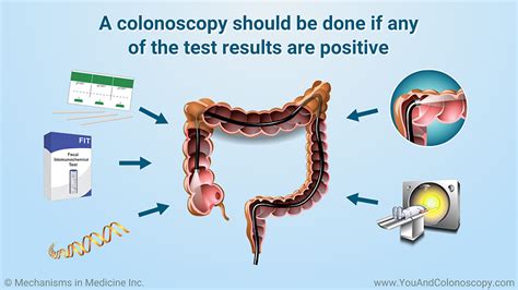 When should a male get a colonoscopy