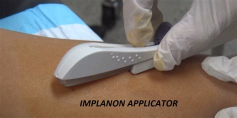When should implanon be inserted