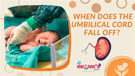 When should umbilical cord fall off