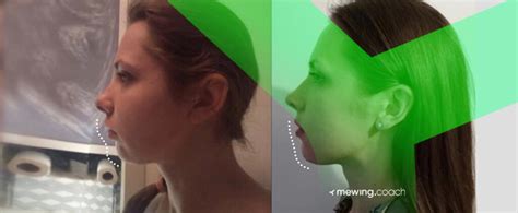 When should you forward face