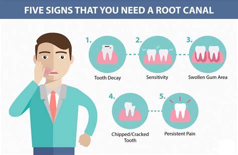When should you get a root canal