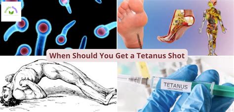 When should you get a tetanus injection