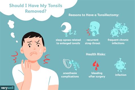 When should you remove your tonsils