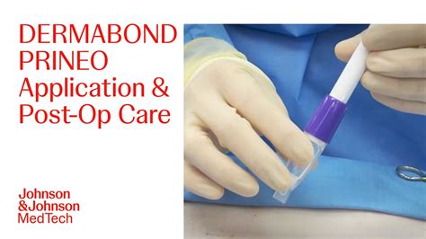 When to remove dermabond after surgery.  Showering is allowed right away after surgery.  The...