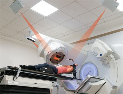 Having radiation therapy in areas near your repro