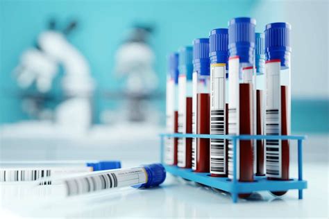 Where Is Whole Blood for Testing in a Clinical Laboratory Collected
