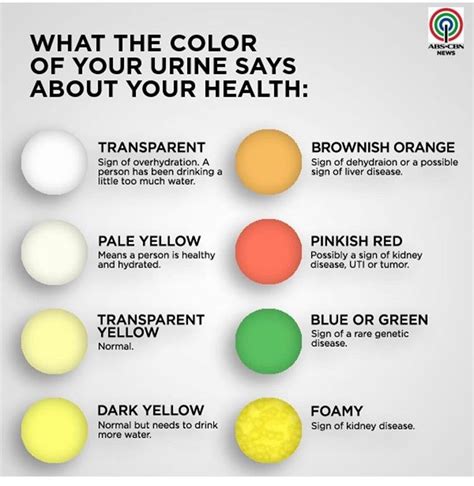 Brownish-Yellow. Pee that's the color of apple juice is the darkest end of the "normal" urine spectrum. While you might assume it means you're super dehydrated, it really just means your ...