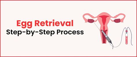 Which day is egg retrieval in ivf