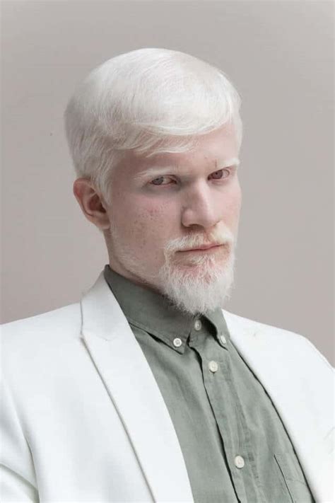 White Beard Coloring