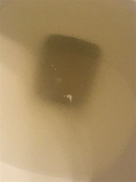 Black, fuzzy looking specks in urine? Symptoms. Last year, I went to the ER with flank pain and nausea, and it turned out to be a 3mm kidney stone. I had a small amount of blood in my urine at the time, and continued to have flank pain for a few weeks, and then nothing. For a week or two after the ER visit, I noticed black flecks in my urine .... 
