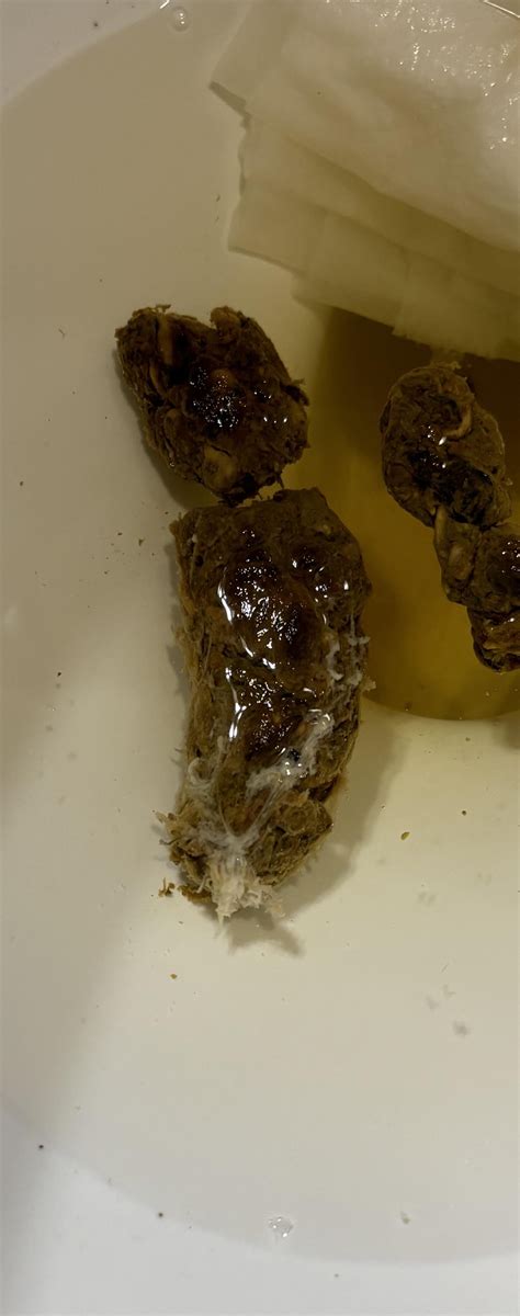 White stringy stuff in stool