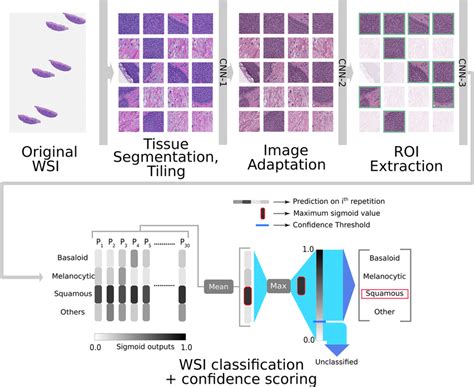 Whole slide scanner.  Using AI-enabled detection, it identifies whole slide image (WSI) ...