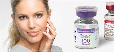 Why BOTOX®? BOTOX® (onabotulinumtoxinA)