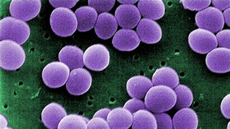 Why Debilitating MRSA Infections Are on the Decline