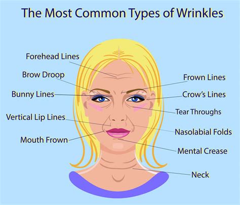 Why Do I Have Wrinkles & Ripples? - Fix My Carpets …