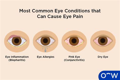 Why Do My Eyes Hurt When I Wake Up? [Causes …