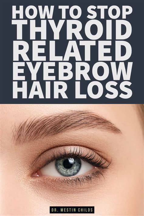 Why Your Eyebrow Hairloss Is A Telltale Sign Of Thyroid …