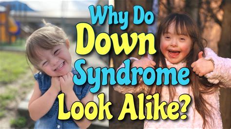 Why do down syndrome people look the same. Overview. The genetic basis of Down syndrome Enlarge image. Down syndrome is a genetic disorder caused when abnormal cell division … 