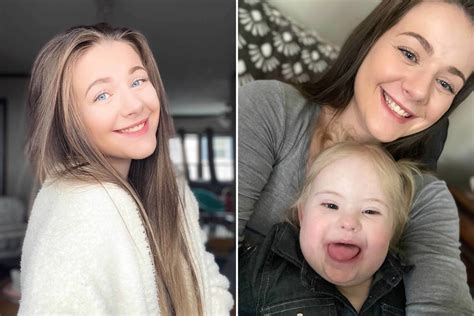 Why do people with down syndrome look the same. Things To Know About Why do people with down syndrome look the same. 