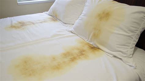 Why does my boyfriend turn the sheets yellow