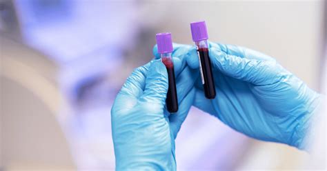 Why is blood so dark when drawn