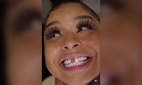 Chrisean Rock gets Blueface face embedded on her new tooth where the missing tooth use to be. Video included👀 Blue Face Eggplant video 🍆https://twitter.com.... 