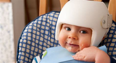 Why would an infant wear a helmet. If a baby has to wear a helmet, it is important that they wear it all the time. In general, the only time the helmet is removed is for bathing and dressing. … 