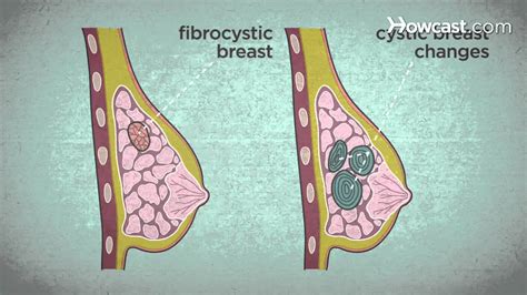 Why would one breast feel heavier than the other - HealthTap