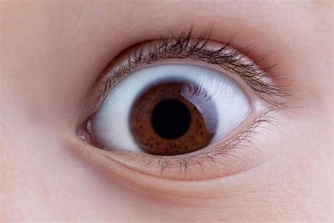 Wide eyes. Eyes that bulge, or protrude, could be a sign of a serious medical condition. Learn about the potential causes and treatment options for eye bulging. 